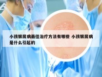 小孩银屑病最佳治疗方法有哪些 小孩银屑病是什么引起的