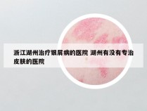 浙江湖州治疗银屑病的医院 湖州有没有专治皮肤的医院