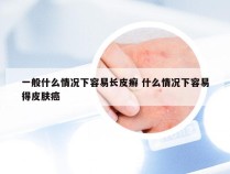 一般什么情况下容易长皮癣 什么情况下容易得皮肤癌