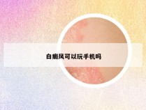 白癜风可以玩手机吗