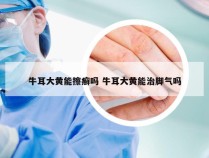 牛耳大黄能擦癣吗 牛耳大黄能治脚气吗