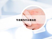 牛皮癣为什么难治愈