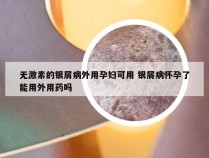 无激素的银屑病外用孕妇可用 银屑病怀孕了能用外用药吗