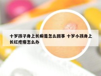 十岁孩子身上长癣是怎么回事 十岁小孩身上长红疙瘩怎么办