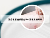 治疗银屑病祥云名气6 治银屑癣专家