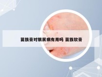 苗族膏对银屑病有用吗 苗族软膏