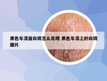 黑色车漆面白斑怎么处理 黑色车漆上的白斑图片