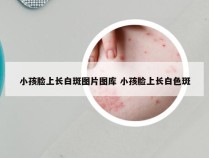 小孩脸上长白斑图片图库 小孩脸上长白色斑