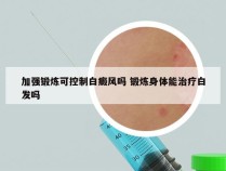 加强锻炼可控制白癜风吗 锻炼身体能治疗白发吗