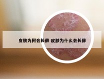 皮肤为何会长藓 皮肤为什么会长藓