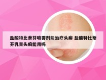 盐酸特比萘芬喷雾剂能治疗头癣 盐酸特比萘芬乳膏头癣能用吗