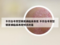 不符合寻常型银屑病临床表现 不符合寻常型银屑病临床表现特点的是