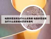 哈西奈德溶液治疗什么皮肤病 哈西奈德溶液治疗什么皮肤病大药房有售吗