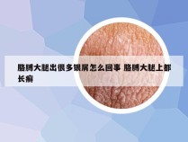 胳膊大腿出很多银屑怎么回事 胳膊大腿上都长癣