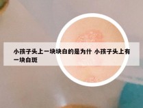 小孩子头上一块块白的是为什 小孩子头上有一块白斑