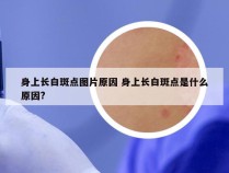 身上长白斑点图片原因 身上长白斑点是什么原因?