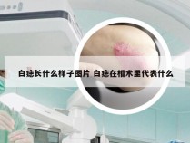 白痣长什么样子图片 白痣在相术里代表什么