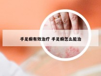 手足癣有效治疗 手足癣怎么能治