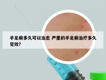 手足癣多久可以治愈 严重的手足癣治疗多久见效?