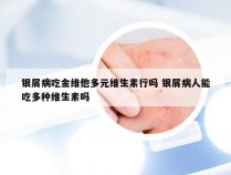 银屑病吃金维他多元维生素行吗 银屑病人能吃多种维生素吗