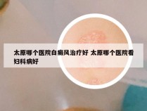 太原哪个医院白癜风治疗好 太原哪个医院看妇科病好