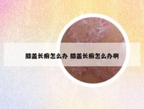 膝盖长癣怎么办 膝盖长癣怎么办啊