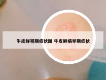 牛皮鲜初期症状图 牛皮鲜病早期症状