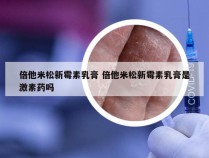 倍他米松新霉素乳膏 倍他米松新霉素乳膏是激素药吗