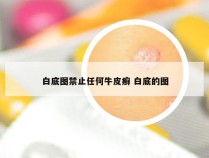 白底图禁止任何牛皮癣 白底的图