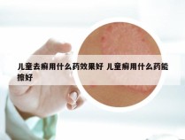 儿童去癣用什么药效果好 儿童癣用什么药能擦好