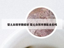 婴儿白斑早期症状 婴儿白斑早期能自愈吗