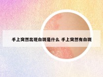 手上突然出现白斑是什么 手上突然有白斑