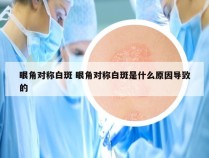 眼角对称白斑 眼角对称白斑是什么原因导致的