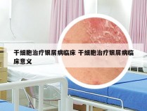 干细胞治疗银屑病临床 干细胞治疗银屑病临床意义