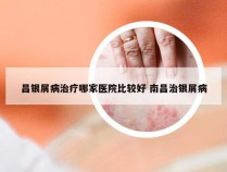 昌银屑病治疗哪家医院比较好 南昌治银屑病