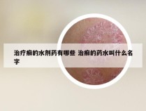 治疗癣的水剂药有哪些 治癣的药水叫什么名字