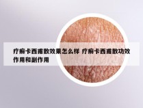 疗癣卡西甫散效果怎么样 疗癣卡西甫散功效作用和副作用