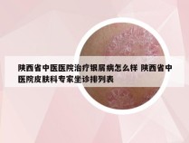 陕西省中医医院治疗银屑病怎么样 陕西省中医院皮肤科专家坐诊排列表