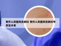 焦作人民医院皮肤科 焦作人民医院皮肤科专家出诊表