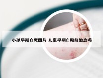 小孩早期白斑图片 儿童早期白殿能治愈吗