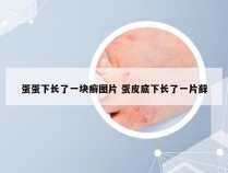 蛋蛋下长了一块癣图片 蛋皮底下长了一片藓