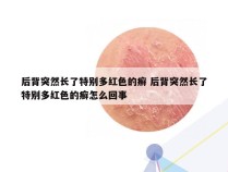 后背突然长了特别多红色的癣 后背突然长了特别多红色的癣怎么回事