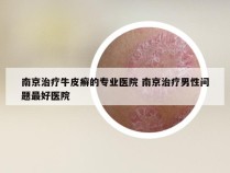 南京治疗牛皮癣的专业医院 南京治疗男性问题最好医院