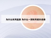 为什么秋天起藓 为什么一到秋天就长皮癣