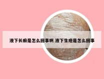 液下长癣是怎么回事啊 液下生疮是怎么回事