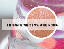 丁香泡酒治癣 酒精泡丁香可以治疗皮肤癣吗