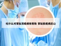 吃什么对掌趾浓疱病有帮助 掌趾脓疱病忌口