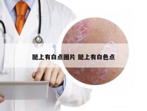 腿上有白点图片 腿上有白色点