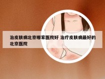 治皮肤病北京哪家医院好 治疗皮肤病最好的北京医院