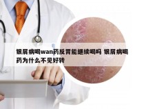 银屑病喝wan药反胃能继续喝吗 银屑病喝药为什么不见好转